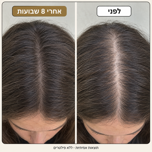 Patchiv™ ספריי רוזמרין ומי אורז