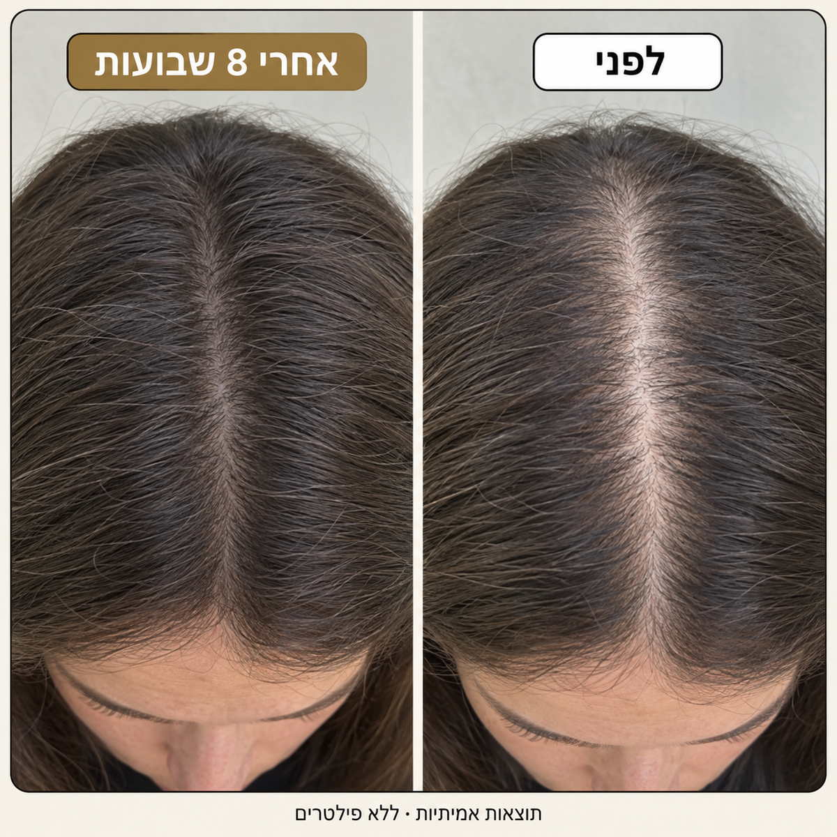 Patchiv™ ספריי רוזמרין ומי אורז