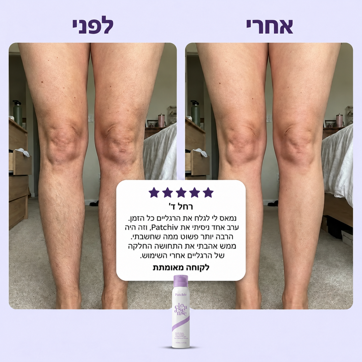 Patchiv™ קצף להסרת שיער ללא כאב